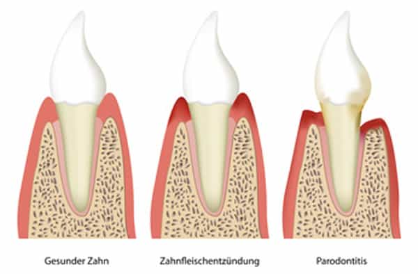 Parodontologie 2